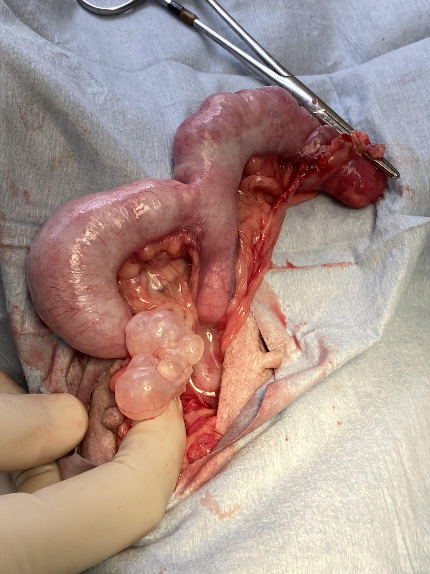 An ovarian surgery
